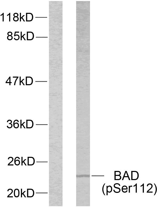 p-BAD (S75) Ab