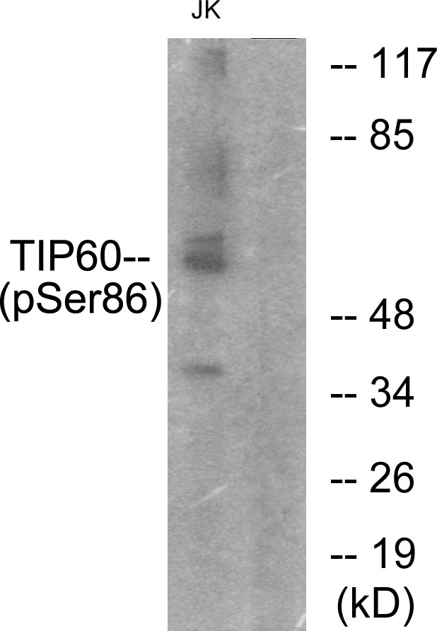 p-KAT5 (S86) Ab