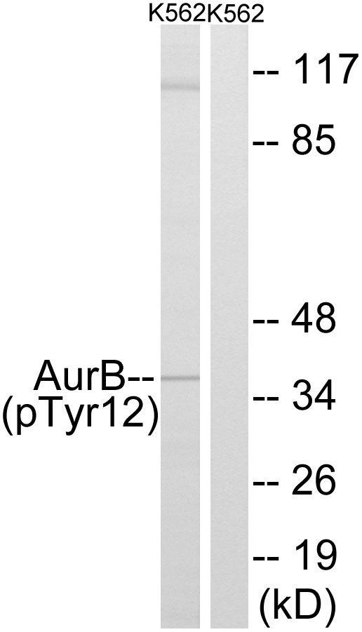 p-Aurora kinase B (Y12) Ab