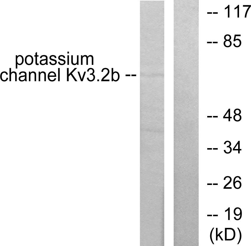 KCNC2 Ab