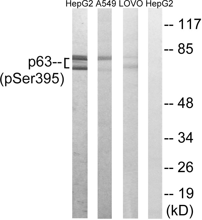 p-p63 (S395) Ab