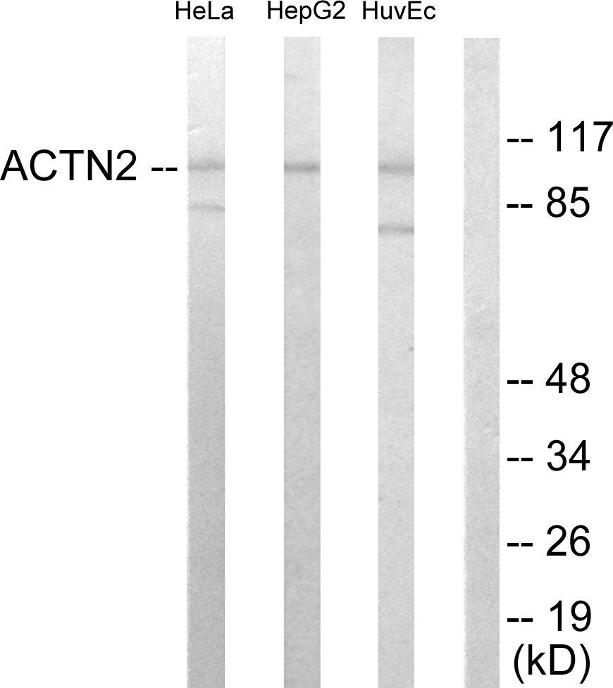 alpha Actinin 2/3 Ab