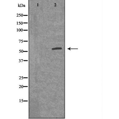 ACVR1B Ab