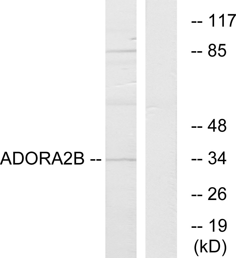 ADORA2B Ab