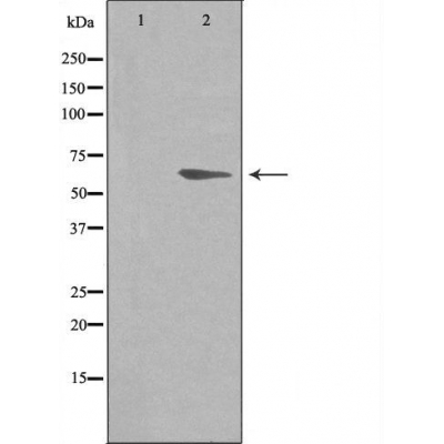 beta 2 Adrenergic receptor Ab