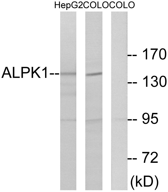 alpha protein kinase 1 Ab