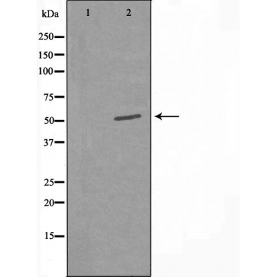 Alkaline phosphatase Ab