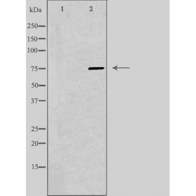 Amphiphysin Ab