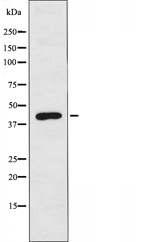 Apolipoprotein L1 Ab