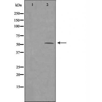 ARMC6 Ab