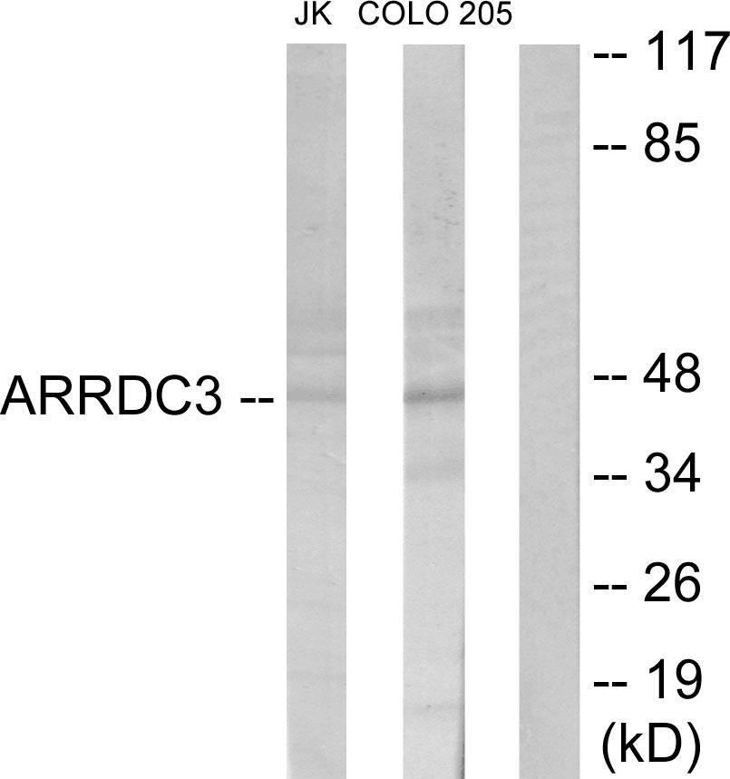 ARRDC3 Ab