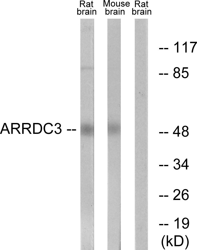 ARRDC3 Ab