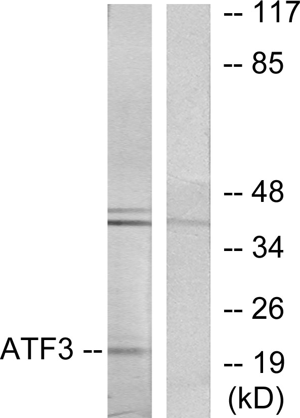 ATF3 Ab