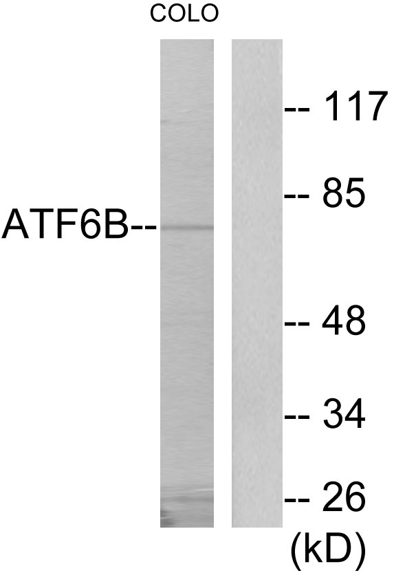 ATF6B Ab