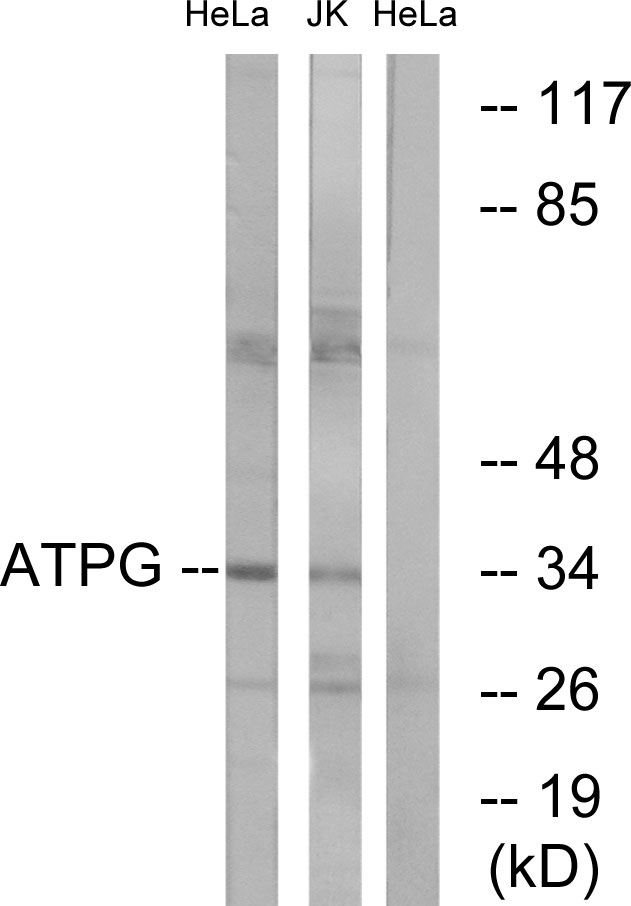 ATP5F1C Ab