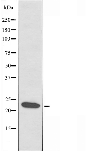 BCAS4 Ab