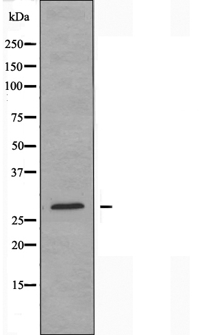 BRI3 binding protein Ab