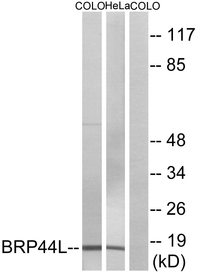 MPC1 Ab