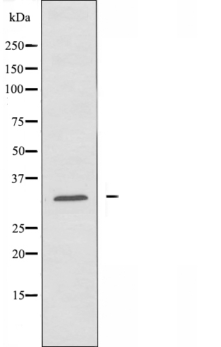 Complement C1q binding protein Ab