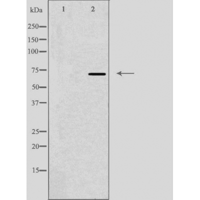 Complement C9 Ab