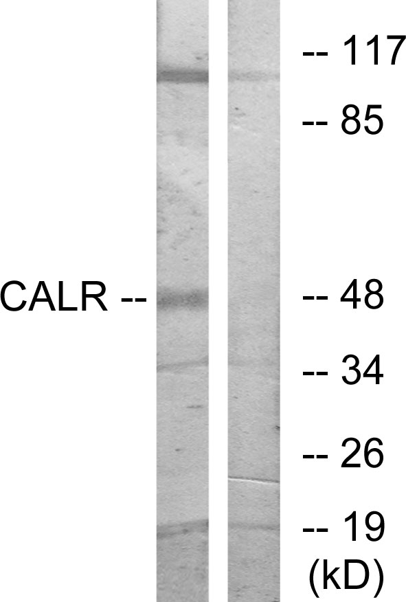 Calreticulin Ab