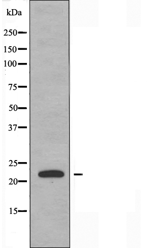 CBF beta Ab