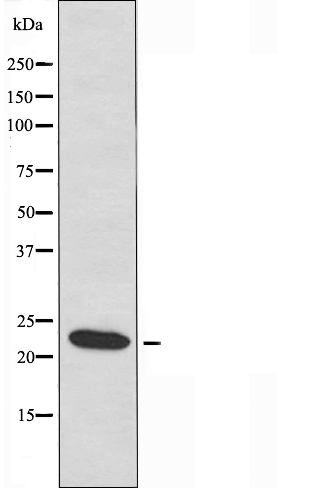 Cerebellin 2 Ab