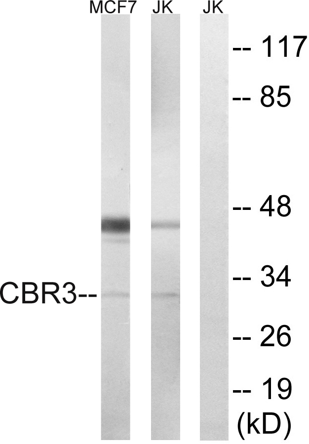 CBR3 Ab