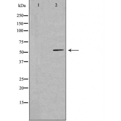 CCDC102A Ab