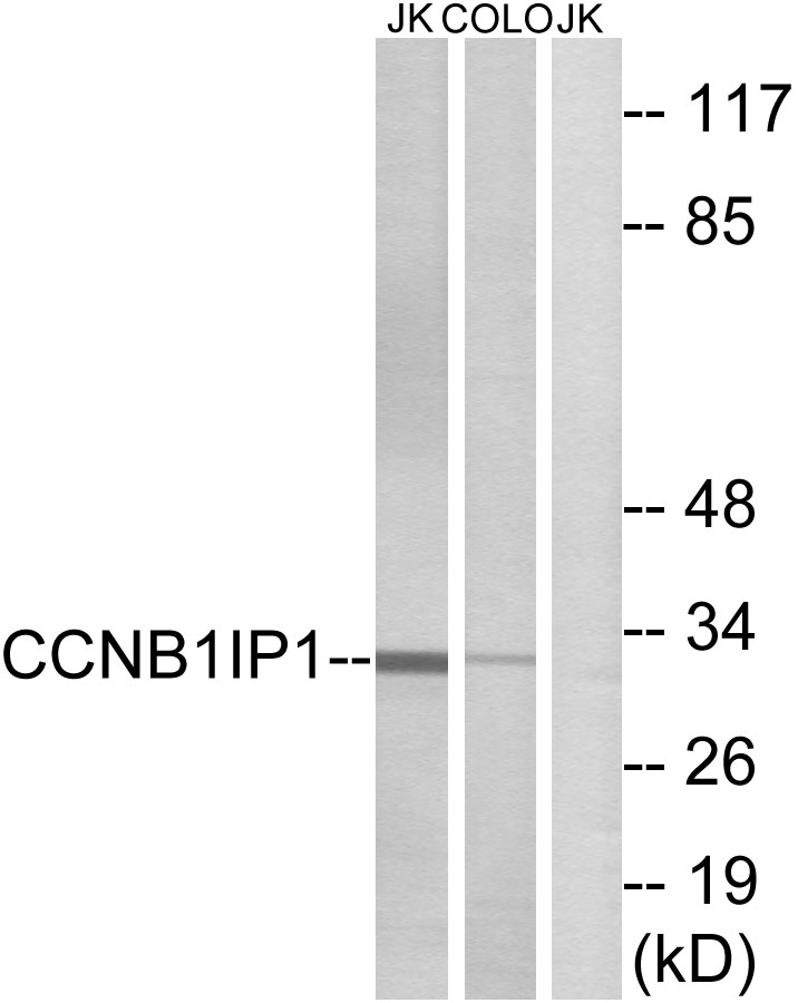 CCNB1IP1 Ab