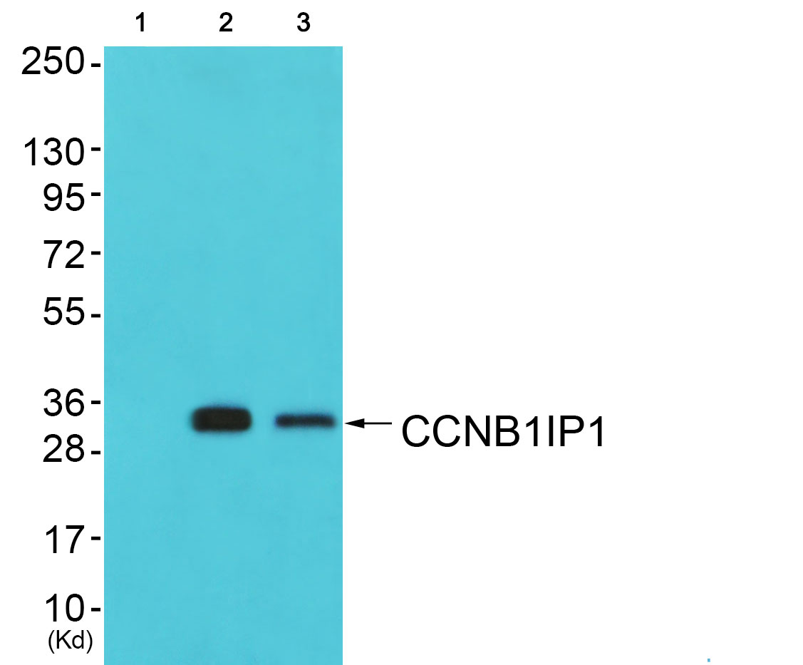 CCNB1IP1 Ab