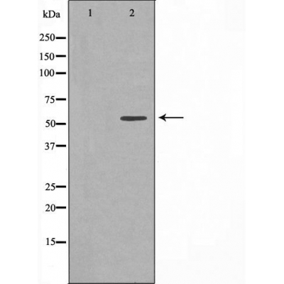 TCP 1 theta Ab