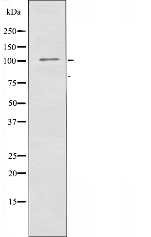 CDCA2 Ab