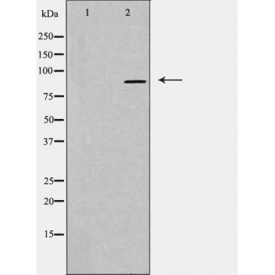 Cadherin 16 Ab