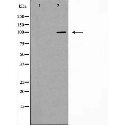 Cadherin 17 Ab