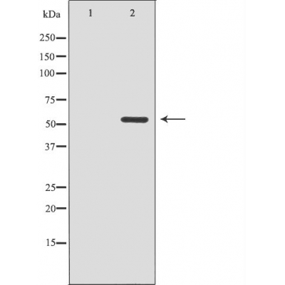 CDK8 Ab