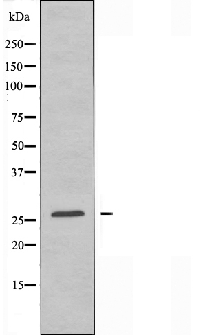 CEBP epsilon Ab