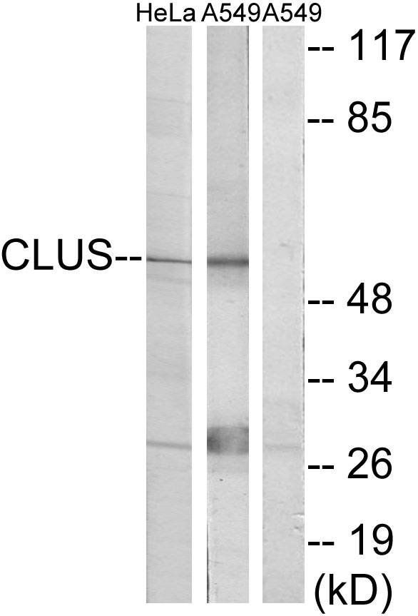 Clusterin Ab