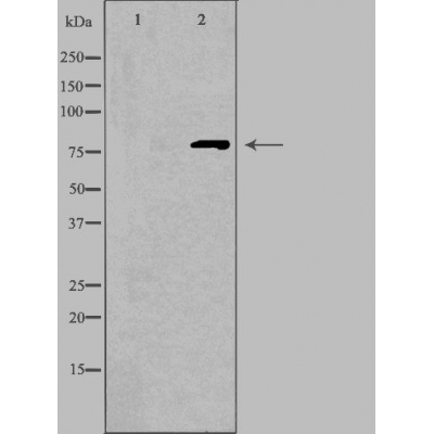 CNGA1 Ab