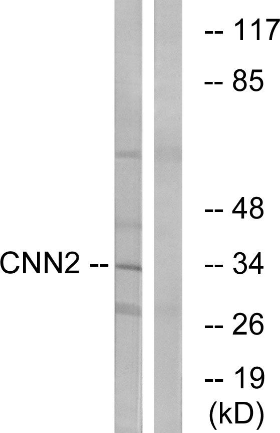 Calponin 2 Ab