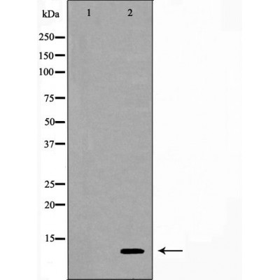 Cystatin A Ab