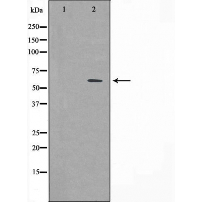 CSTF2 Ab