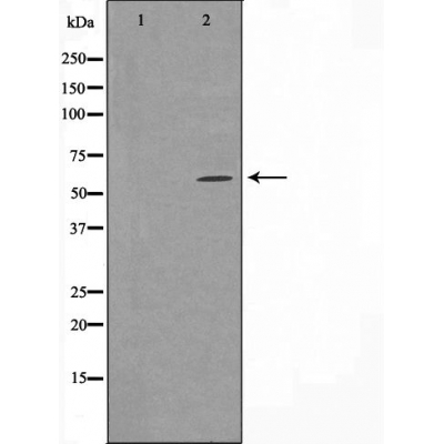 Cytochrome P450 24A1 Ab