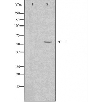 Cytochrome P450 2A6 Ab