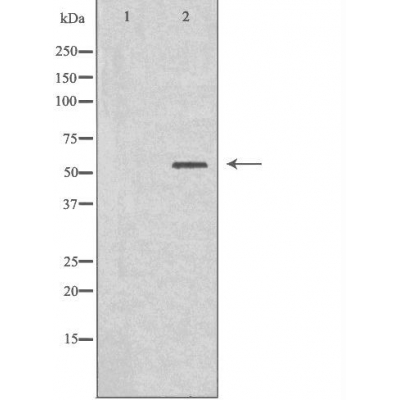 Cytochrome P450 2B6 Ab