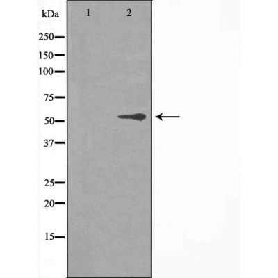 Cytochrome P450 2R1 Ab