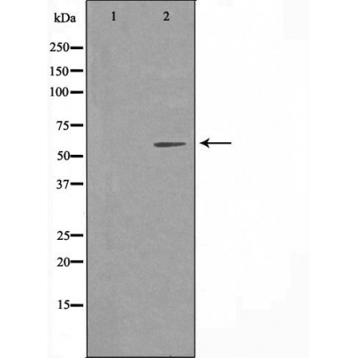 Cytochrome P450 4A11/4A22 Ab