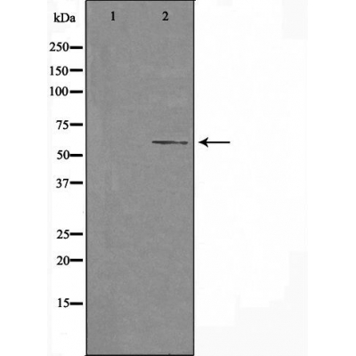 Cytochrome P450 4F11 Ab