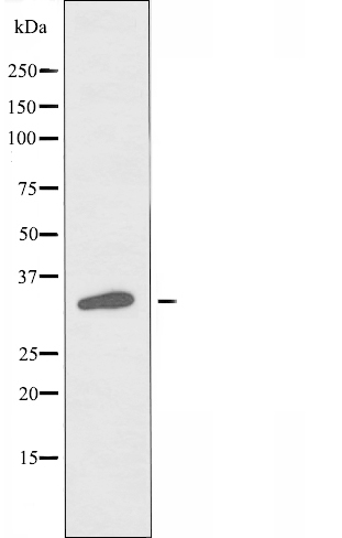 DNAJC17 Ab