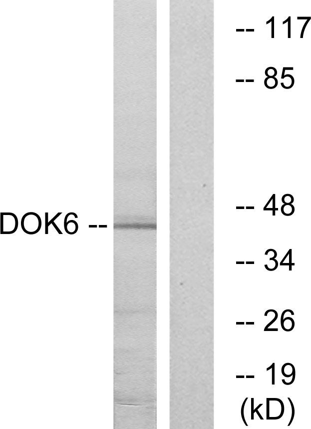 DOK6 Ab